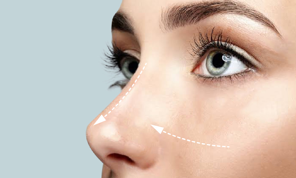 Nose Aesthetics (Rhinoplasty) Surgery