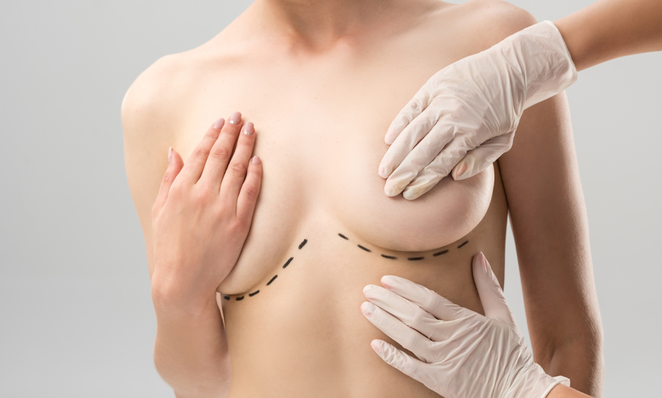 Chirurgie D’augmentation Mammaire