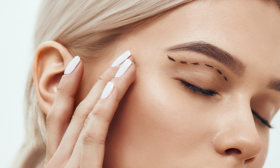 Блефаропластика (эстетика век)